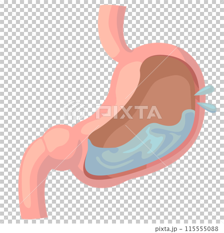 胃液がたくさんあふれ出る胃袋の中 胃液がたくさんあふれ出る胃袋の中 115555088