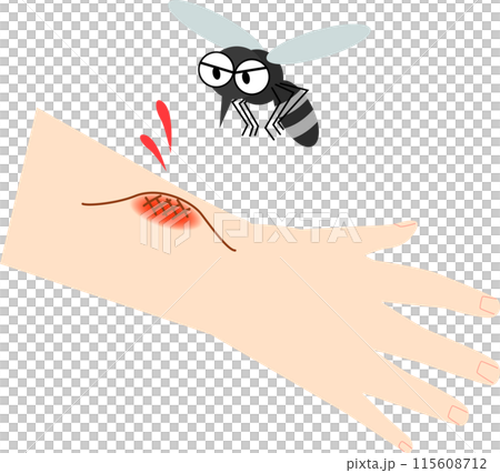 蚊に刺された手 115608712