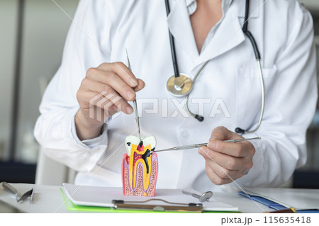 Doctor shows dental disease . Doctor shows dental disease . 115635418
