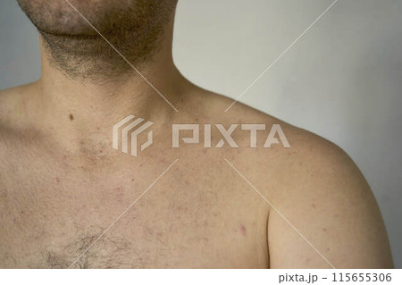 shoulder of a thirty-year-old man of medium build 115655306