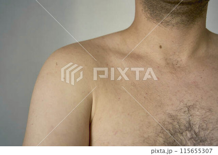shoulder of a thirty-year-old man of medium build shoulder of a thirty-year-old man of medium build 115655307
