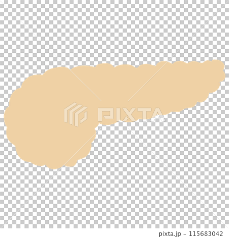 不健康胰腺的插圖 115683042
