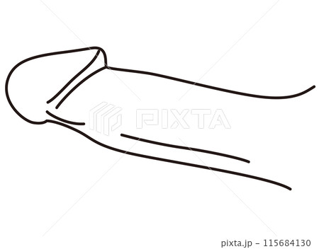 男性生殖器　医療 115684130