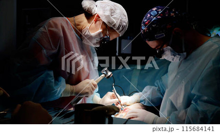 Dedicated surgeon with team of medical assistants meticulously operates on patient. High-tech surgical suite surgeon leads complex operation with support of skilled assistants surgical interventions. Dedicated surgeon with team of medical assistants meticulously operates on patient. High-tech surgical suite surgeon leads complex operation with support of skilled assistants surgical interventions. 115684141