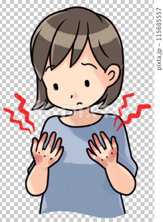 Rough-handed woman 115685557