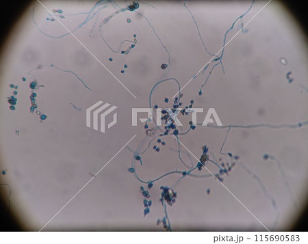 冷蔵庫のパッキンに生えていたカビ 冷蔵庫のパッキンに生えていたカビ 115690583