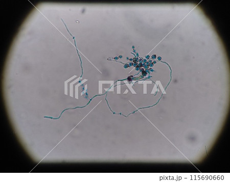 冷蔵庫に発生したカビの菌糸と胞子 冷蔵庫に発生したカビの菌糸と胞子 115690660