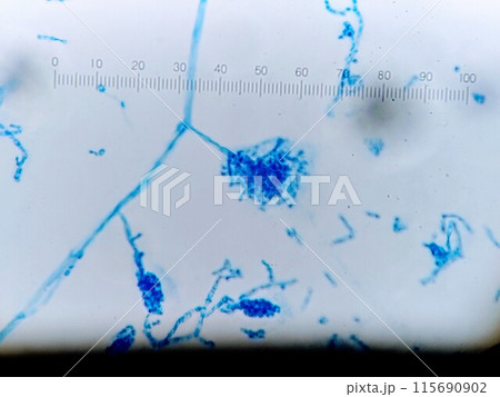 きれいな胞子嚢をもつカビ きれいな胞子嚢をもつカビ 115690902