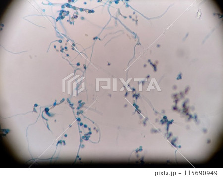 顕微鏡で観察できるカビの菌糸 顕微鏡で観察できるカビの菌糸 115690949