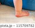 手足口病にかかった赤ちゃんの足 115709782