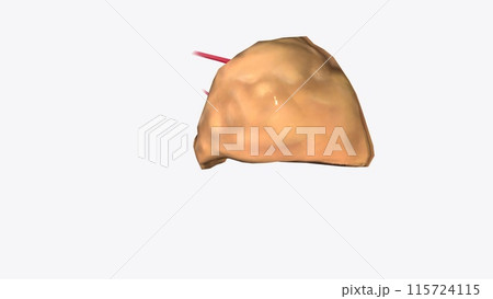 small gland that makes steroid hormones, adrenaline, and noradrenaline small gland that makes steroid hormones, adrenaline, and noradrenaline 115724115