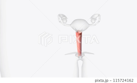 The vagina is a closed muscular canal that extends from the outside of the female genital area 115724162