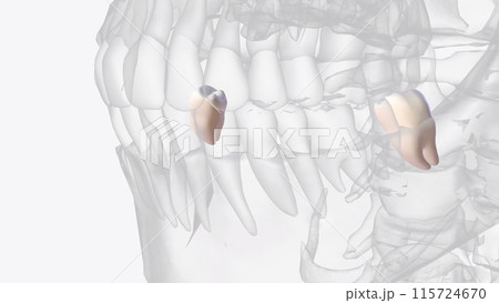 Mandibular third molars usually have two roots: mesial and distal as on mandibular first and second molars Mandibular third molars usually have two roots: mesial and distal as on mandibular first and second molars 115724670