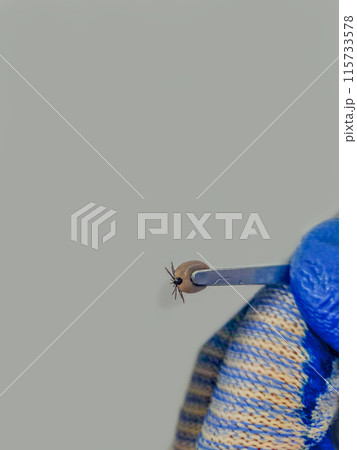 A large parasitic mite is held with tweezers by a hand wearing blue textile gloves, attacked a cat and was removed from its ears. Wild insects that parasitize domestic animals. Defense against attack 115733578