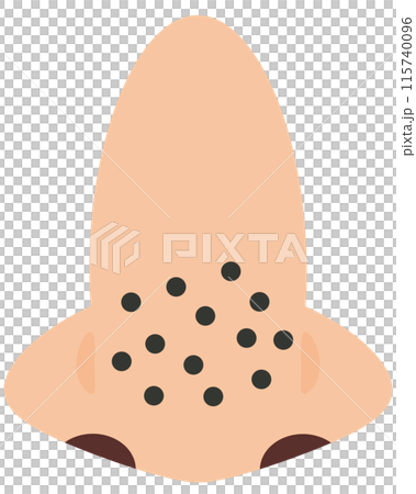 鼻子腫塊 115740096