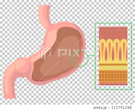 An enlarged illustration of the stomach showing the tissue structure of the stomach wall 115741298