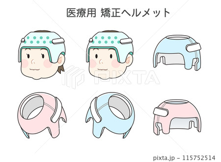 矯正ヘルメット、赤ちゃん、ベビー、イラスト 矯正ヘルメット、赤ちゃん、ベビー、イラスト 115752514