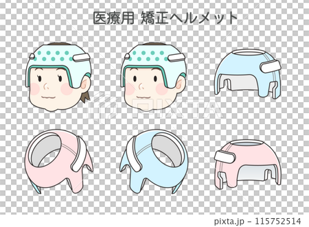 矯正ヘルメット、赤ちゃん、ベビー、イラスト 矯正ヘルメット、赤ちゃん、ベビー、イラスト 115752514