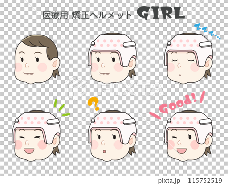 矯正ヘルメット、赤ちゃん、女の子、ベビー、イラスト 矯正ヘルメット、赤ちゃん、女の子、ベビー、イラスト 115752519