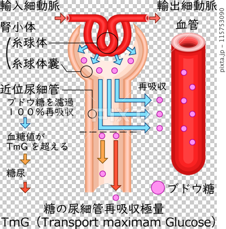 Renal corpuscle diabetes illustration Japanese 115753090