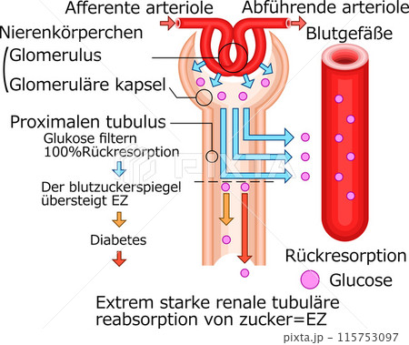 腎小体 糖尿 イラスト ドイツ語 腎小体 糖尿 イラスト ドイツ語 115753097
