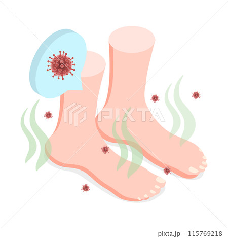 3D Isometric Flat  Illustration of Feet Unpleasant Smell, Fungal Lesions 115769218