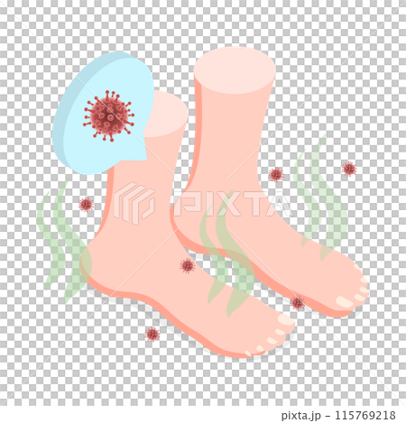 3D Isometric Flat  Illustration of Feet Unpleasant Smell, Fungal Lesions 115769218