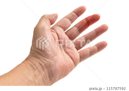 男性の手の中指に発症したヘバーデン結節 115787592