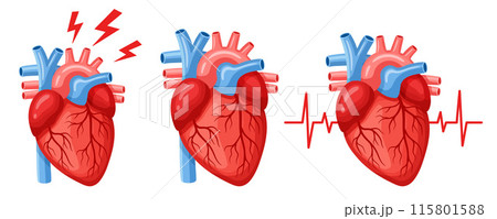 Human heart internal organ, cardiac muscle anatomy, heartache, cardiology medicine, heartbeat pulse. Cardiovascular attack disease treatment, medical cardiogram. Body blood system. Health care vector Human heart internal organ, cardiac muscle anatomy, heartache, cardiology medicine, heartbeat pulse. Cardiovascular attack disease treatment, medical cardiogram. Body blood system. Health care vector 115801588