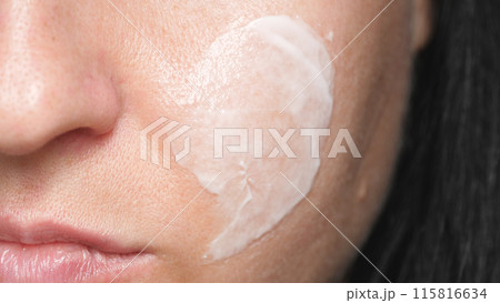 Facial skin with enlarged pores. Cream on the skin. Care for problem skin. Facial skin with enlarged pores. Cream on the skin. Care for problem skin. 115816634