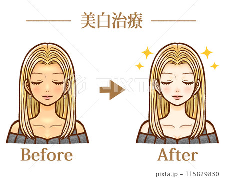 美白治療を受けた大人女性のビフォーアフターのイラスト素材 115829830
