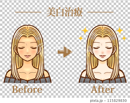 成年女性接受美白治療前後插畫素材 115829830