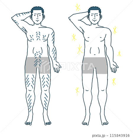 男性の脱毛全身イラスト 115843916