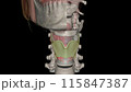 The thyrohyoid membrane (or hyothyroid membrane) is a broad, fibro-elastic sheet of the larynx 115847387