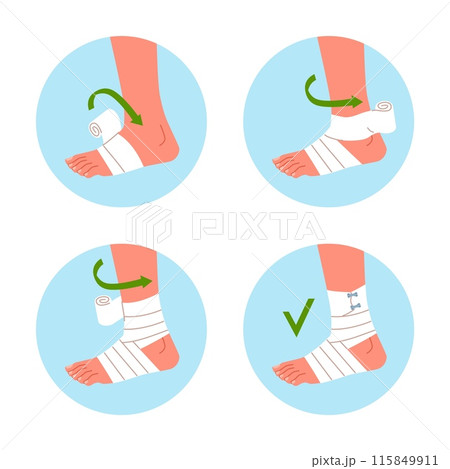 Bandaging scheme. Applying medical bandage or plaster on injured ankle, step by step instructions, trauma fixation, nowaday vector cartoon flat isolated traumatology infographics poster Bandaging scheme. Applying medical bandage or plaster on injured ankle, step by step instructions, trauma fixation, nowaday vector cartoon flat isolated traumatology infographics poster 115849911