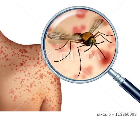 Mosquito Bites 115860003