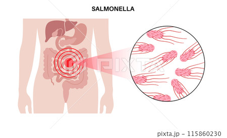 .Salmonella Typhimurium Cells 115860230