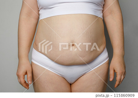 Woman with fat abdomen close up 115860909