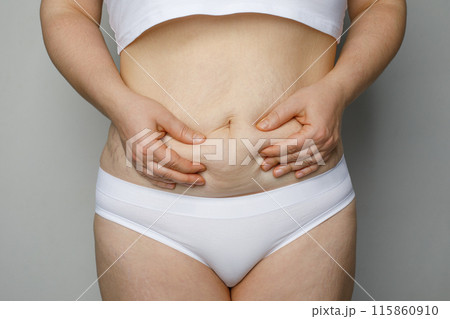 Closeup women waist with thick fat tummy. Female abdomen, lady plus size big belly 115860910