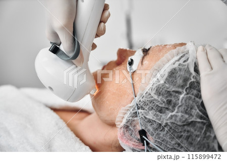 A woman receives IPL therapy in a beauty salon. A woman receives IPL therapy in a beauty salon. 115899472