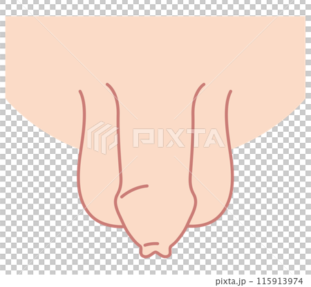 Uncircumcised male genitalia medical Uncircumcised male genitalia medical 115913974