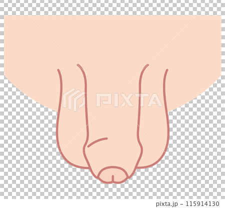 Male genitalia with phimosis - Medical Male genitalia with phimosis - Medical 115914130