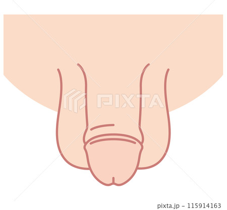 男性生殖器　医療 115914163