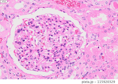 腎臓の細胞（HE染色） 115920329
