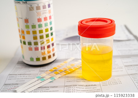 Urinalysis, urine cup with reagent strip pH paper test and comparison chart in laboratory. 115923338
