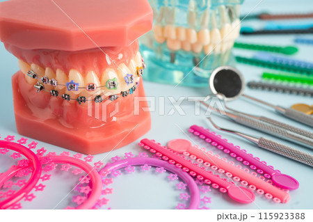 Orthodontic ligatures rings and ties, elastic rubber bands on orthodontic braces, model for dentist studying about dentistry. Orthodontic ligatures rings and ties, elastic rubber bands on orthodontic braces, model for dentist studying about dentistry. 115923388