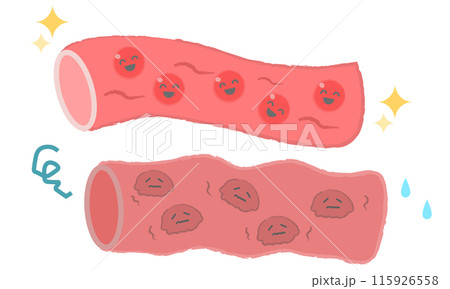 血管のイラスト サラサラの血・どろどろの血 血管のイラスト サラサラの血・どろどろの血 115926558