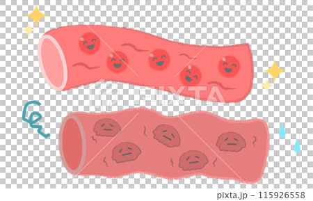 血管のイラスト サラサラの血・どろどろの血 血管のイラスト サラサラの血・どろどろの血 115926558