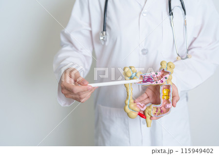 Doctor holding human Colon anatomy model. Colonic disease, Large Intestine, Colorectal cancer, Ulcerative colitis, Diverticulitis, Irritable bowel syndrome, Digestive system and Health concept Doctor holding human Colon anatomy model. Colonic disease, Large Intestine, Colorectal cancer, Ulcerative colitis, Diverticulitis, Irritable bowel syndrome, Digestive system and Health concept 115949402