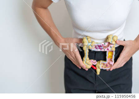 Woman holding human Colon anatomy model. Colonic disease, Large Intestine, Colorectal cancer, Ulcerative colitis, Diverticulitis, Irritable bowel syndrome, Digestive system and Health concept Woman holding human Colon anatomy model. Colonic disease, Large Intestine, Colorectal cancer, Ulcerative colitis, Diverticulitis, Irritable bowel syndrome, Digestive system and Health concept 115950456